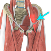 Hip Flexor Strain